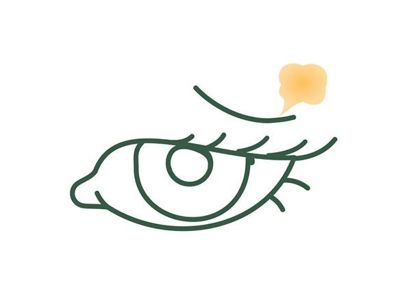 まぶたの脂肪取り