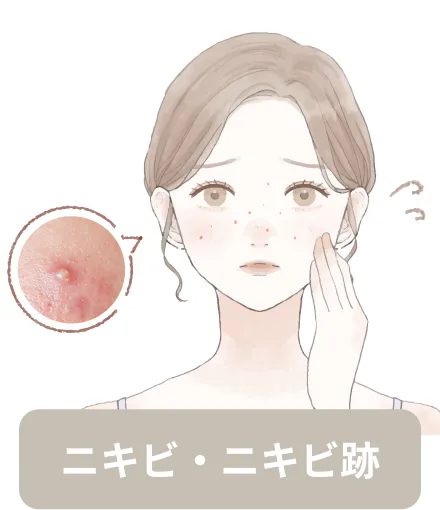 ニキビ・ニキビ跡