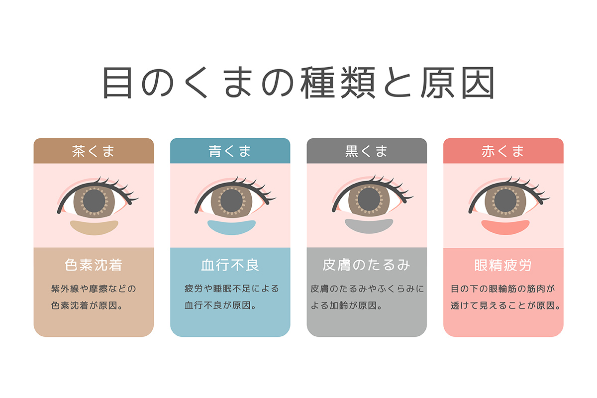第1章 あなたのクマは色素沈着？「茶クマ」の見分け方