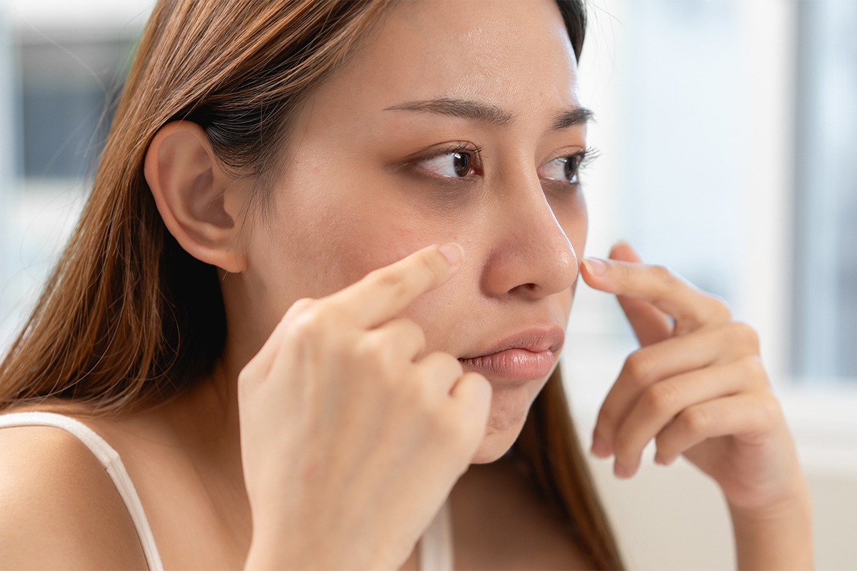 2-4. 黒クマ(影クマ)の根本原因