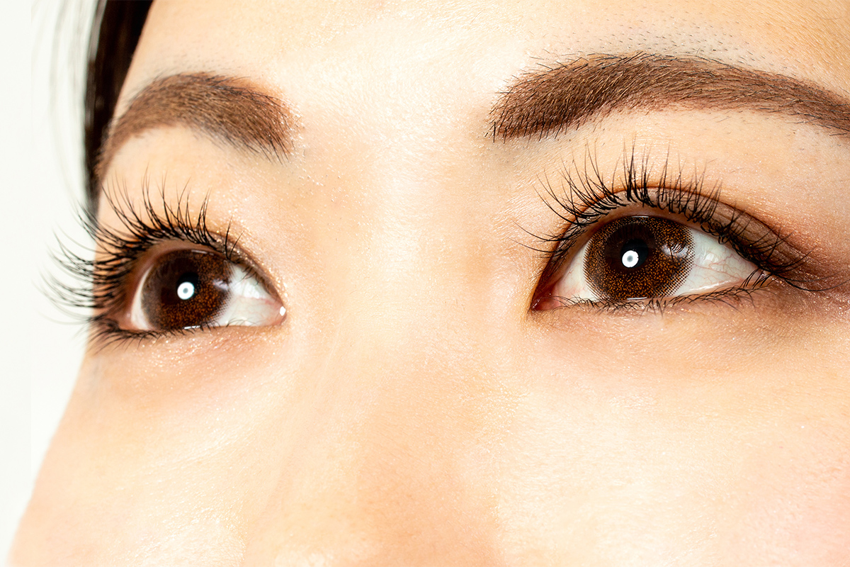 第3章 目の下のふくらみの美容治療