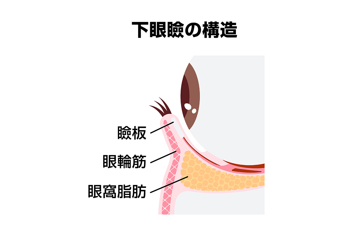 第1章 「切らないクマ取り」=メスを使わないクマ取り?