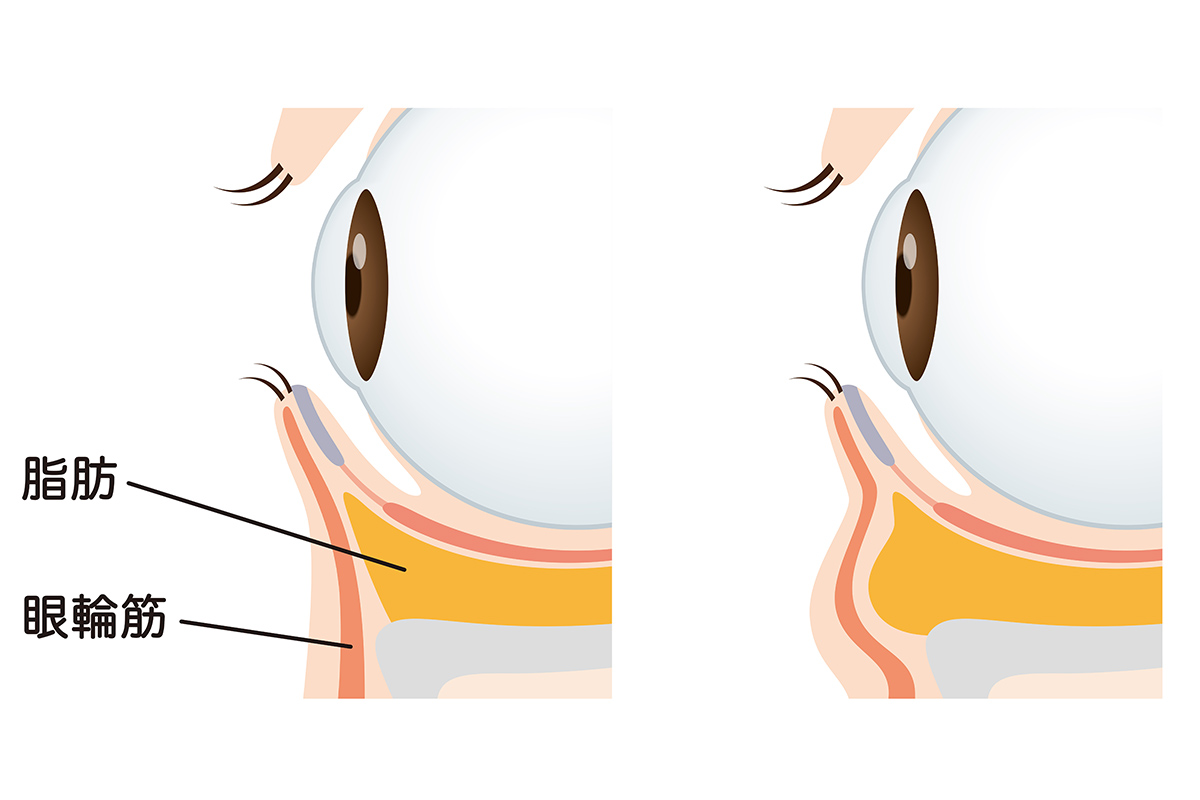 1-2. 加齢による筋肉や皮膚の衰え