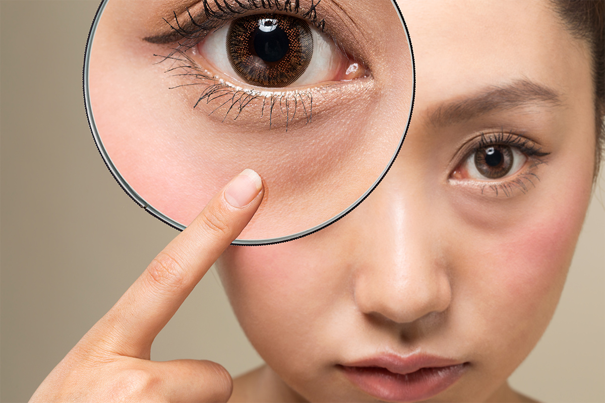 第4章 脂肪注入は必要?不要?