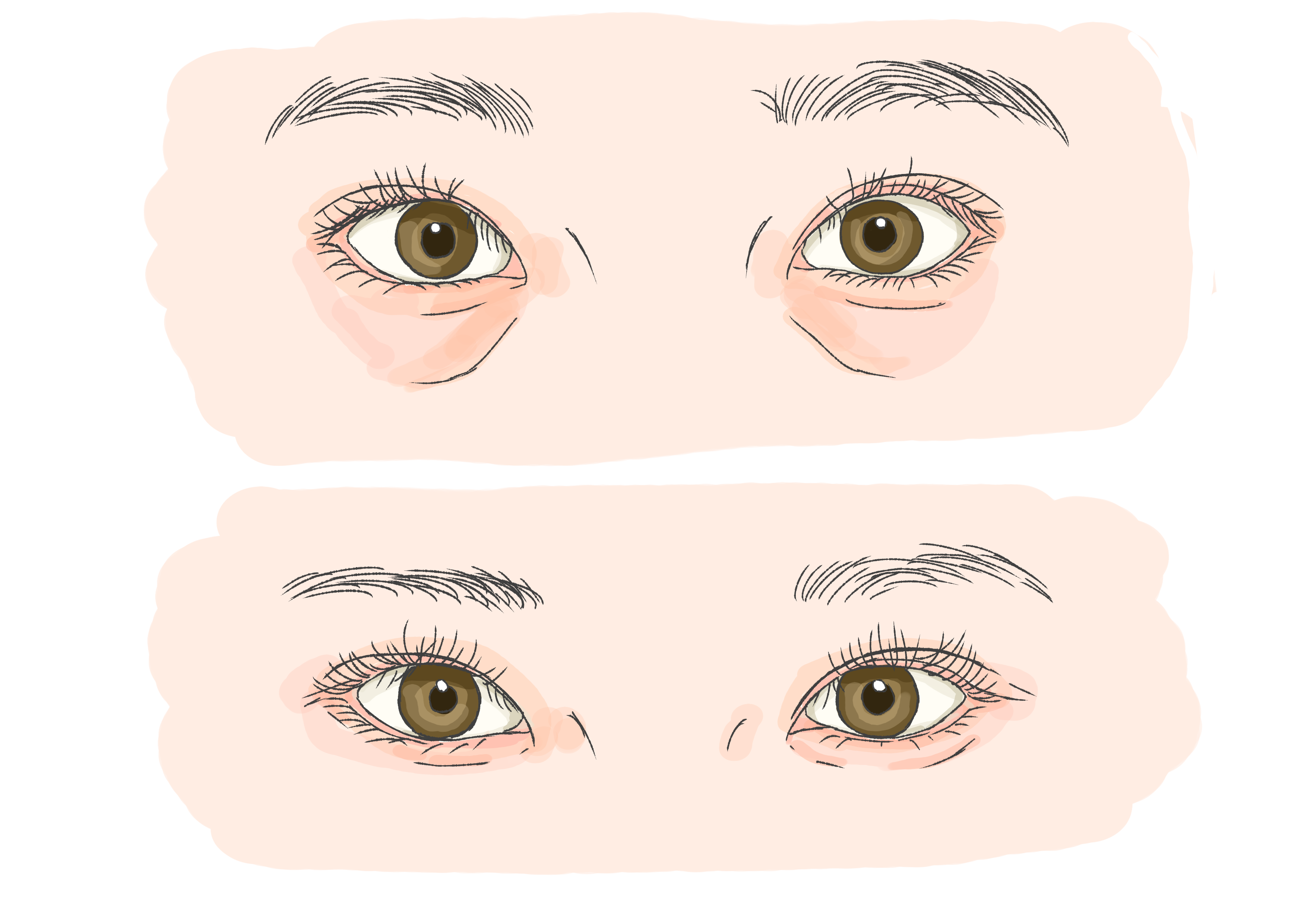 第1章 表ハムラ法とは？